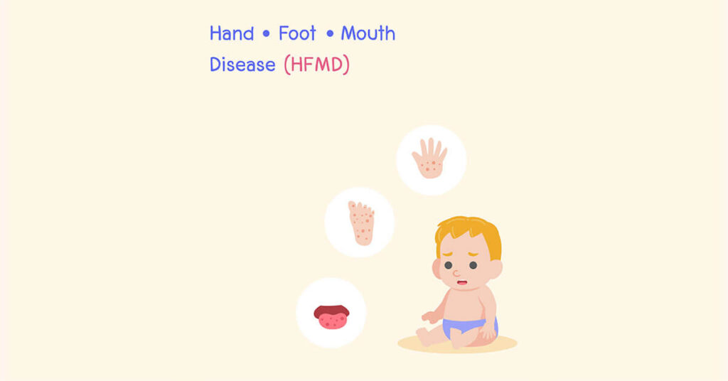 Children's Dermatology Blog - What is Hand, Foot, and Mouth Disease?